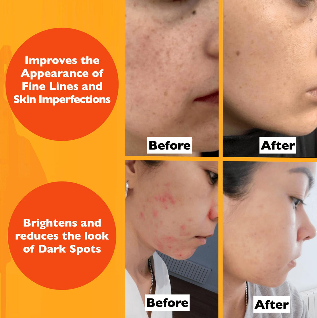 Vitamin C Anti-Aging Face Serum - 2 Fl Oz