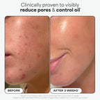 Paula's Choice 2% BHA Liquid Exfoliant