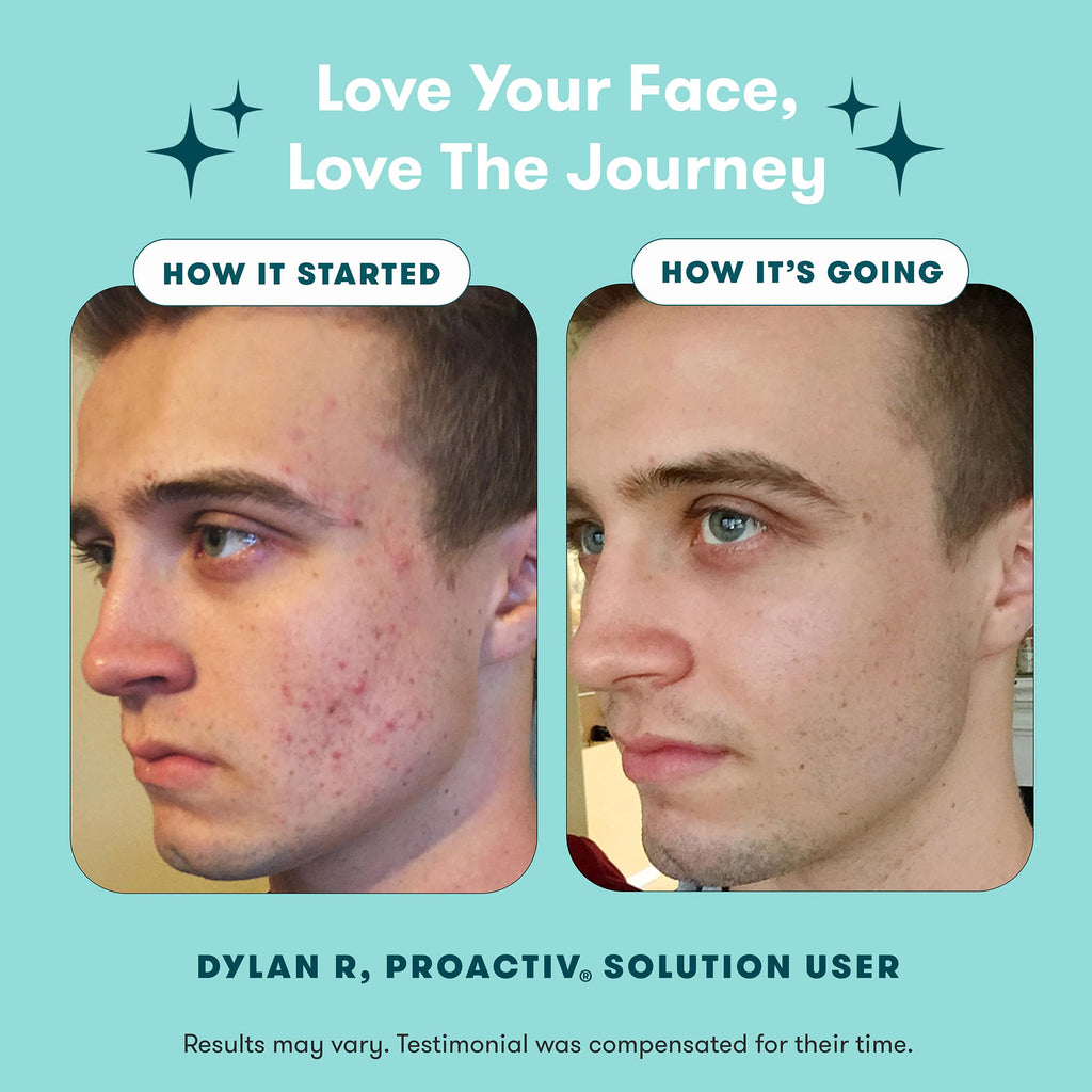 ClearSkin 3-Step Acne Care Kit: Wash, Treat, Tone - Beauty & Personal Care by Handbags Specialist Headquarter | Available at Handbags Specialist Headquarter