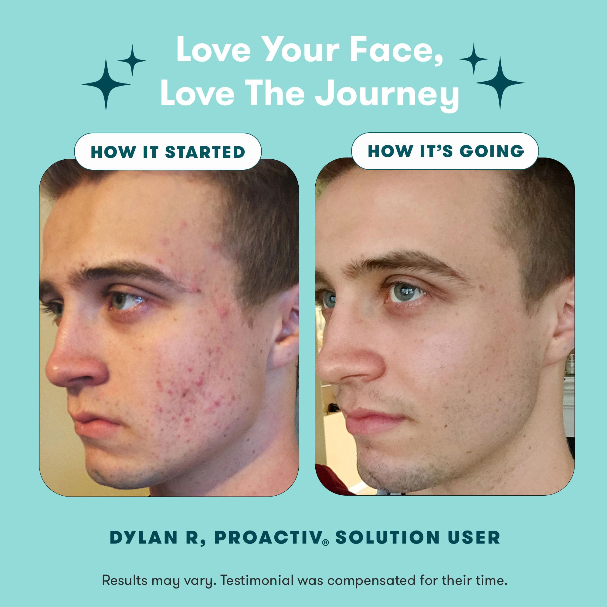 Proactiv 3 Step Acne Treatment Kit + Patches