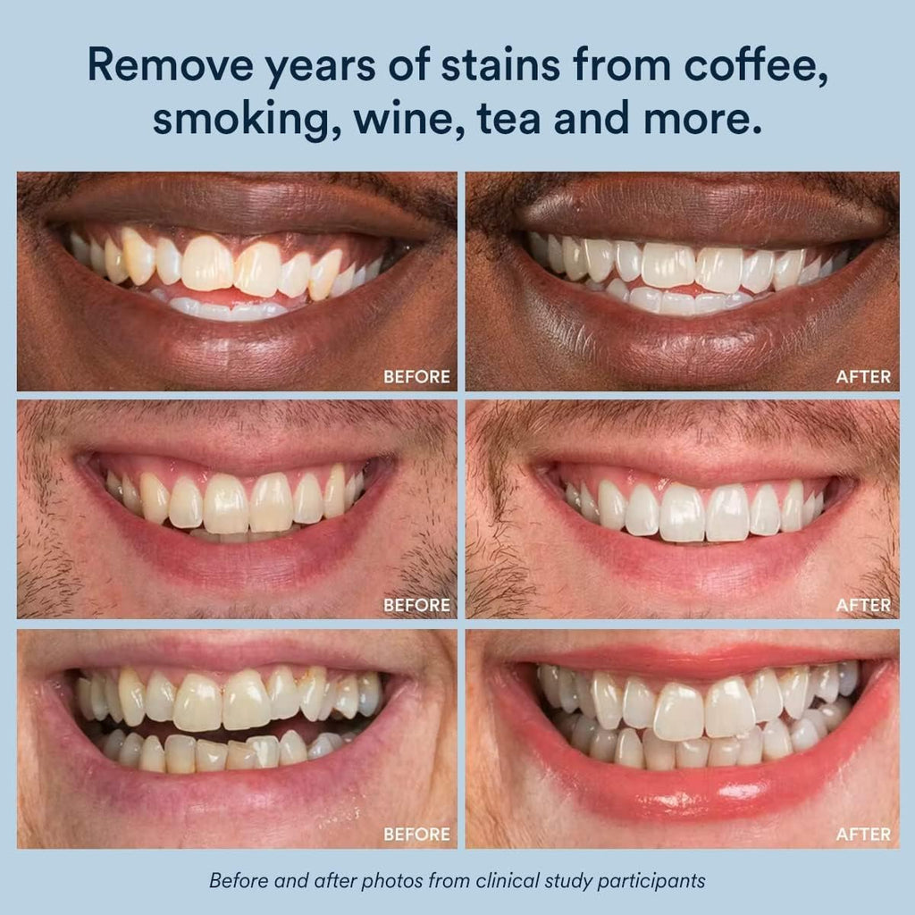 Auraglow PowerWhite Teeth Whitening Pen 4mL - Health Care by Handbags Specialist Headquarter | Available at Handbags Specialist Headquarter