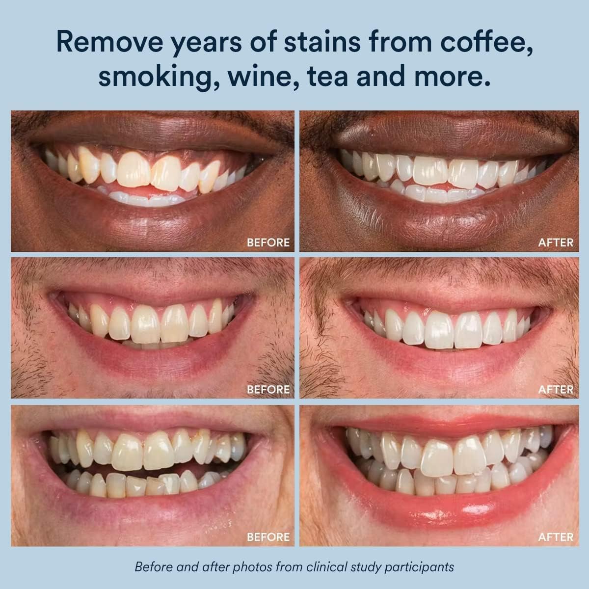 Auraglow PowerWhite Teeth Whitening Pen 4mL - Health Care by Handbags Specialist Headquarter | Available at Handbags Specialist Headquarter