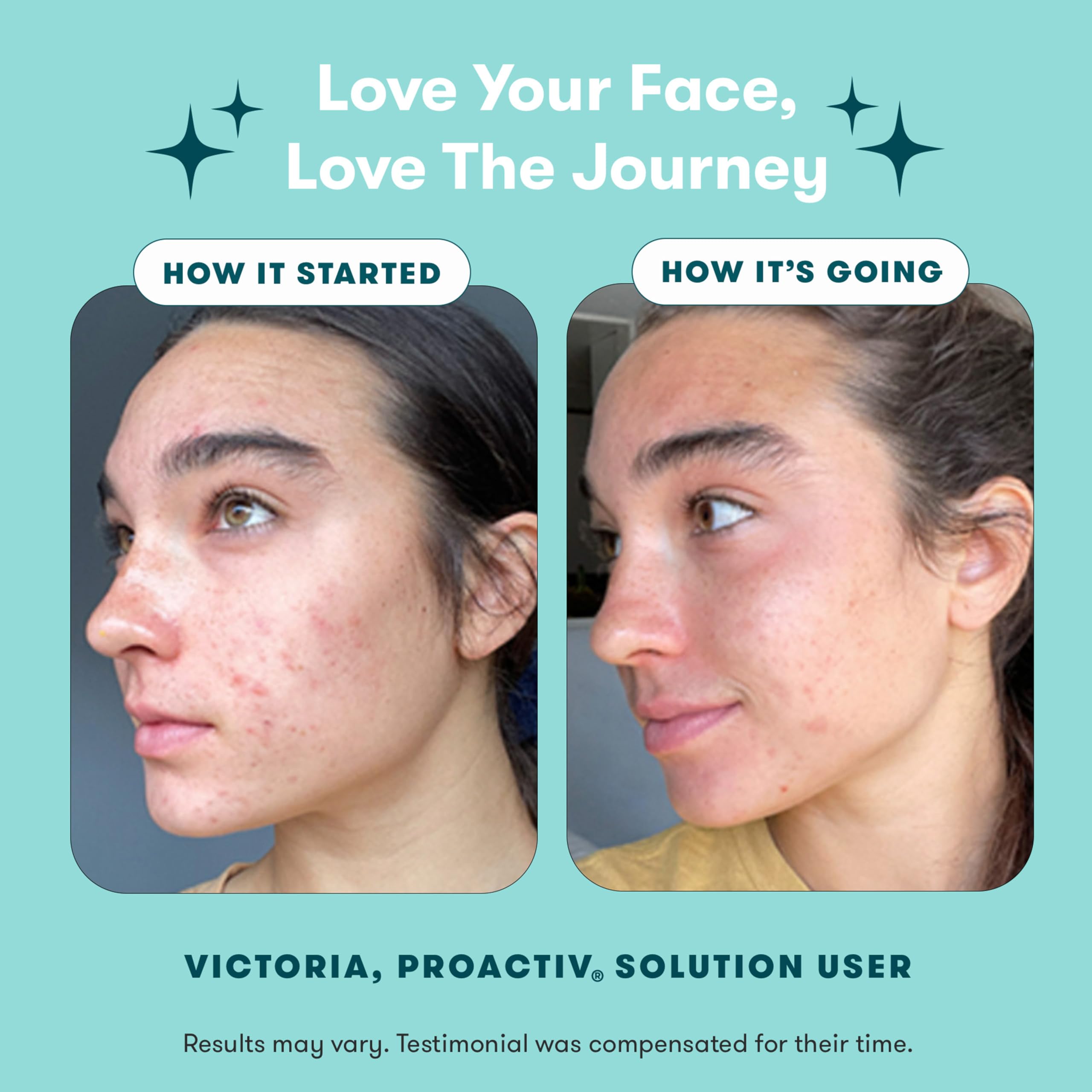 Proactiv 3 Step Acne Treatment Kit + Patches