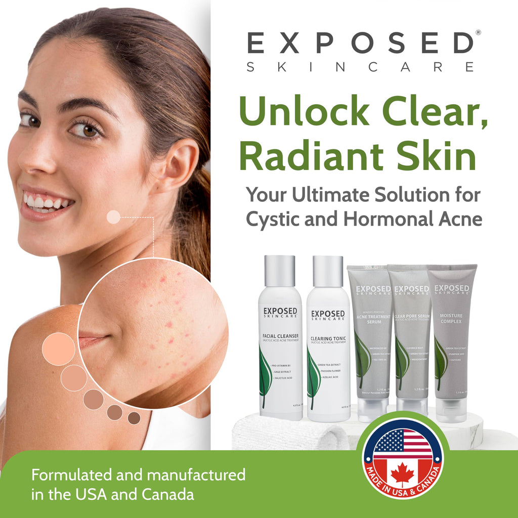 ClearSkin Duo: Natural Acne Solution Kit - Beauty & Personal Care by Handbags Specialist Headquarter | Available at Handbags Specialist Headquarter