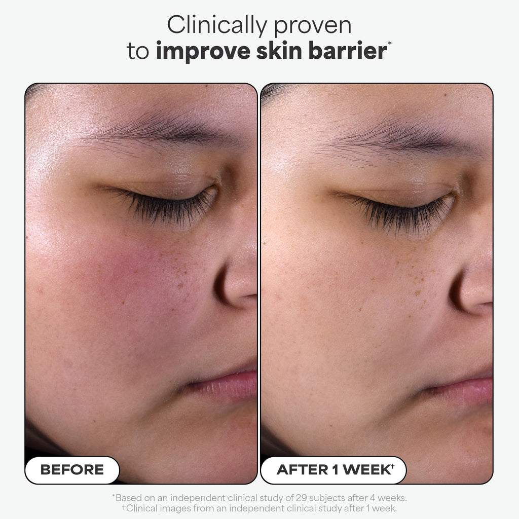 Paula's Choice 2% BHA Liquid Exfoliant
