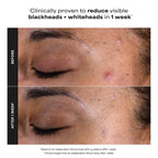 Paula's Choice 2% BHA Liquid Exfoliant
