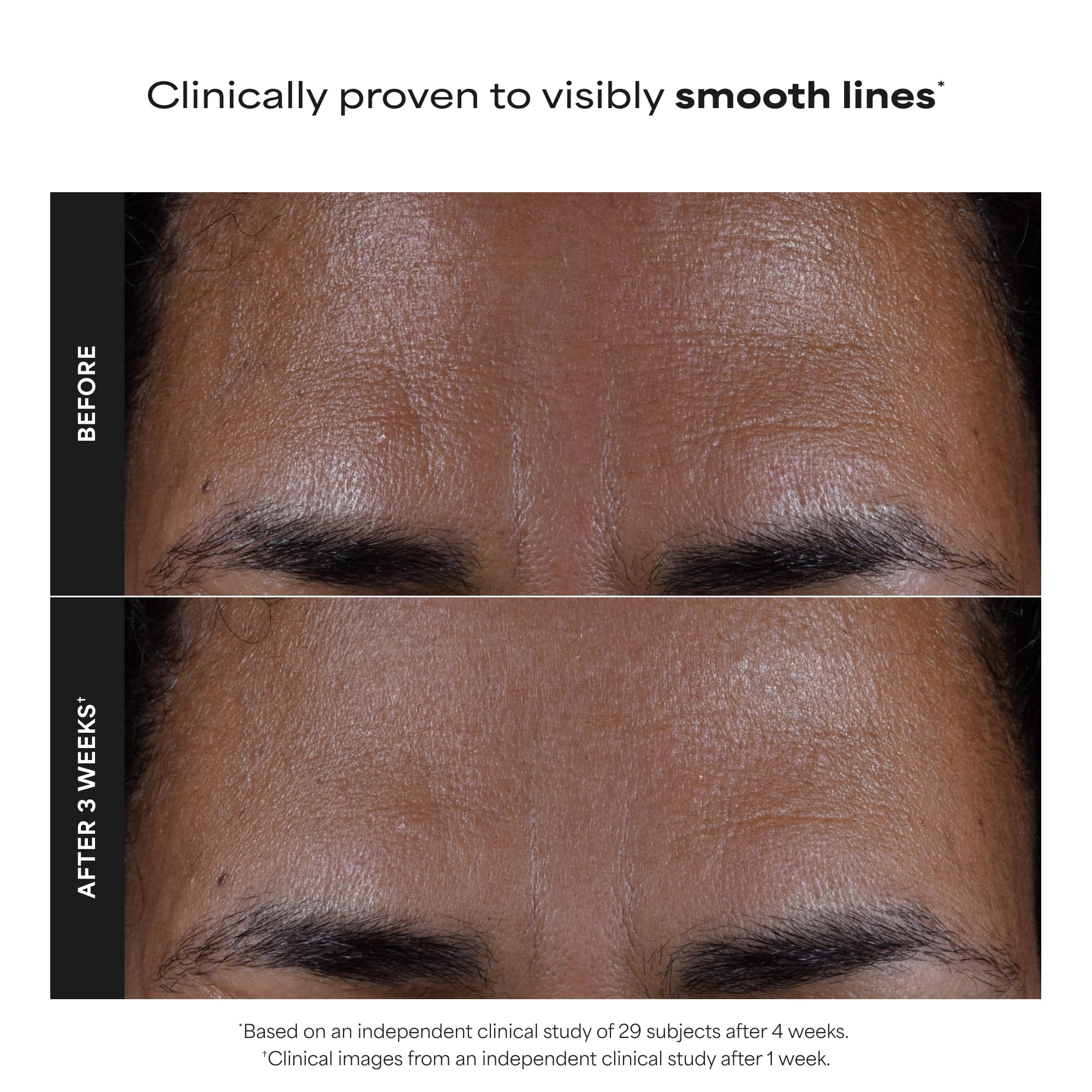 Paula's Choice 2% BHA Liquid Exfoliant
