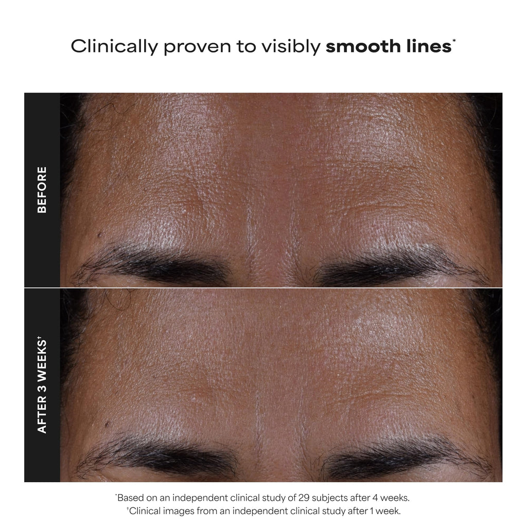 Paula's Choice 2% BHA Liquid Exfoliant